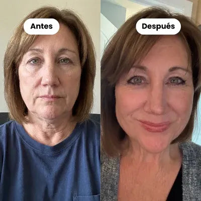 Somnivita® Antifaz Ergonómico Total Dark