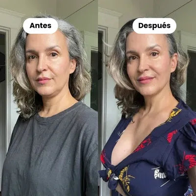 Somnivita® Antifaz Ergonómico Total Dark